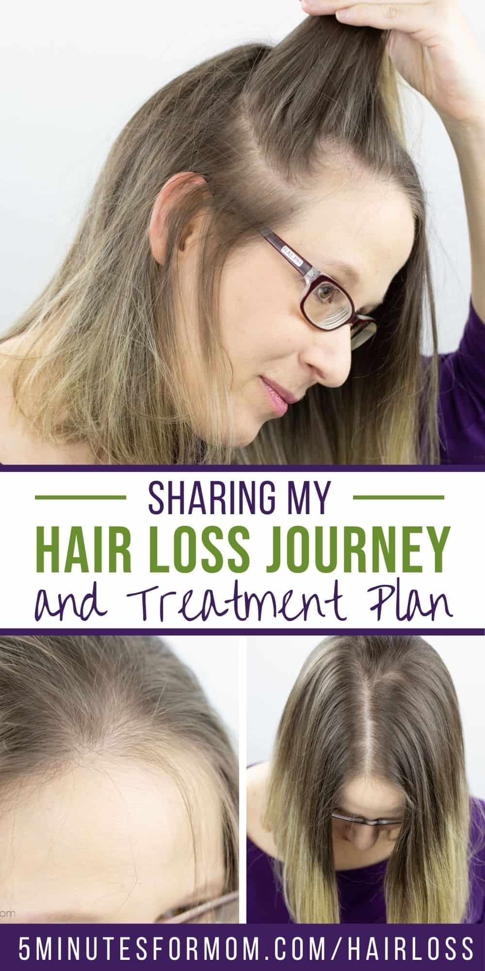 Hair loss Journey