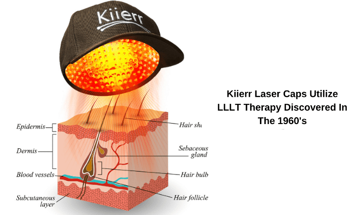The science and Impact of laser cap on scalp