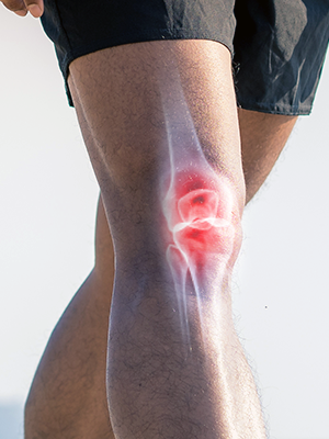 knee joints hip arthritis neuropathy